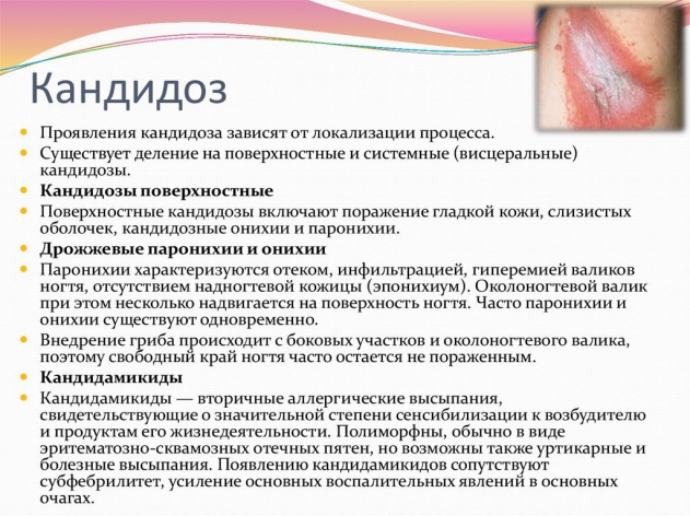 Кандидоз у женщин — симптомы, признаки, цены на лечение в Новороссийске