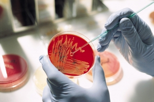 Микроскопические исследования для диагностики инфекционных заболеваний