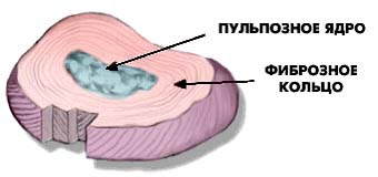 строение межпозвонкового диска